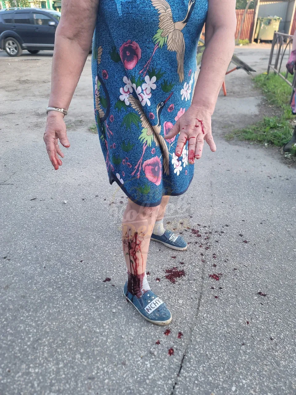 ❗️ Снова нападение стаи собак  На пересечении Дегтярева и К. Маркса. Пострадавшую женщину еле отбили