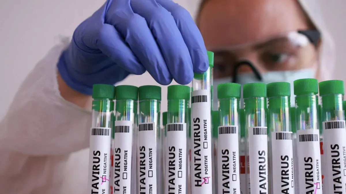 Rossiyada xantavirus bormi?  2026-yil 14-may kuni ekspertlar xantavirus tarqalishi bilan bog'liq v