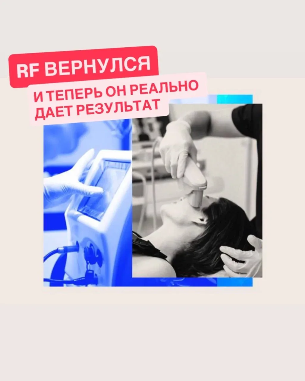 Девочки, если вы думали, что аппаратка «уже всё» — нет 😏👇  💥 RF-лифтинг вернулся. И теперь он реальн