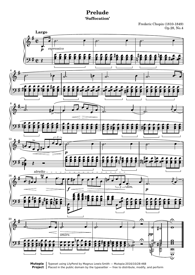 Прелюдия №4 ми минор («Удушье»), Op. 28 №4