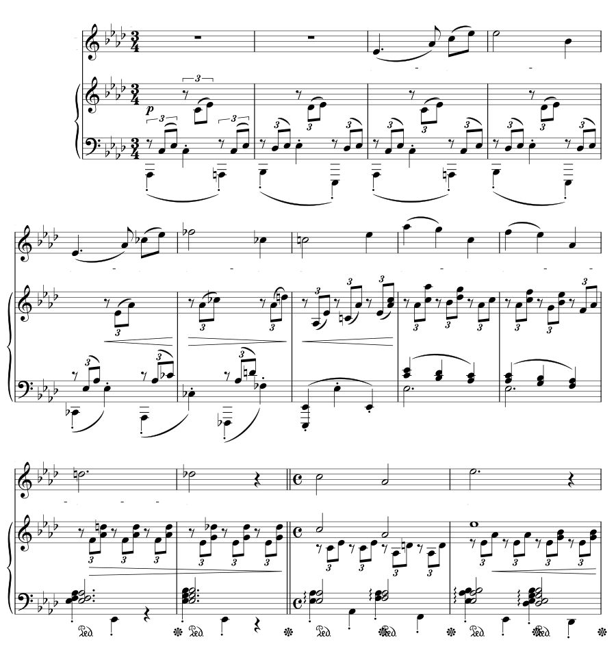 Тоска (Sehnsucht). 5 песен, соч. 49