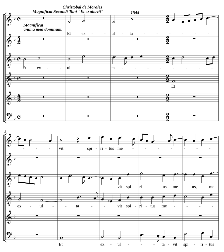 Magnificat Secundi Toni 'Et exultavit'
