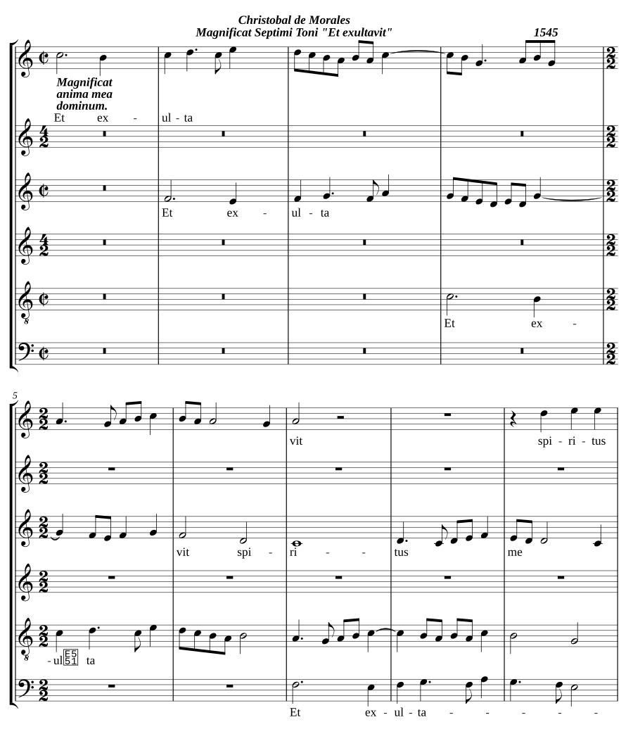 Magnificat Septimi Toni 'Et exultavit'