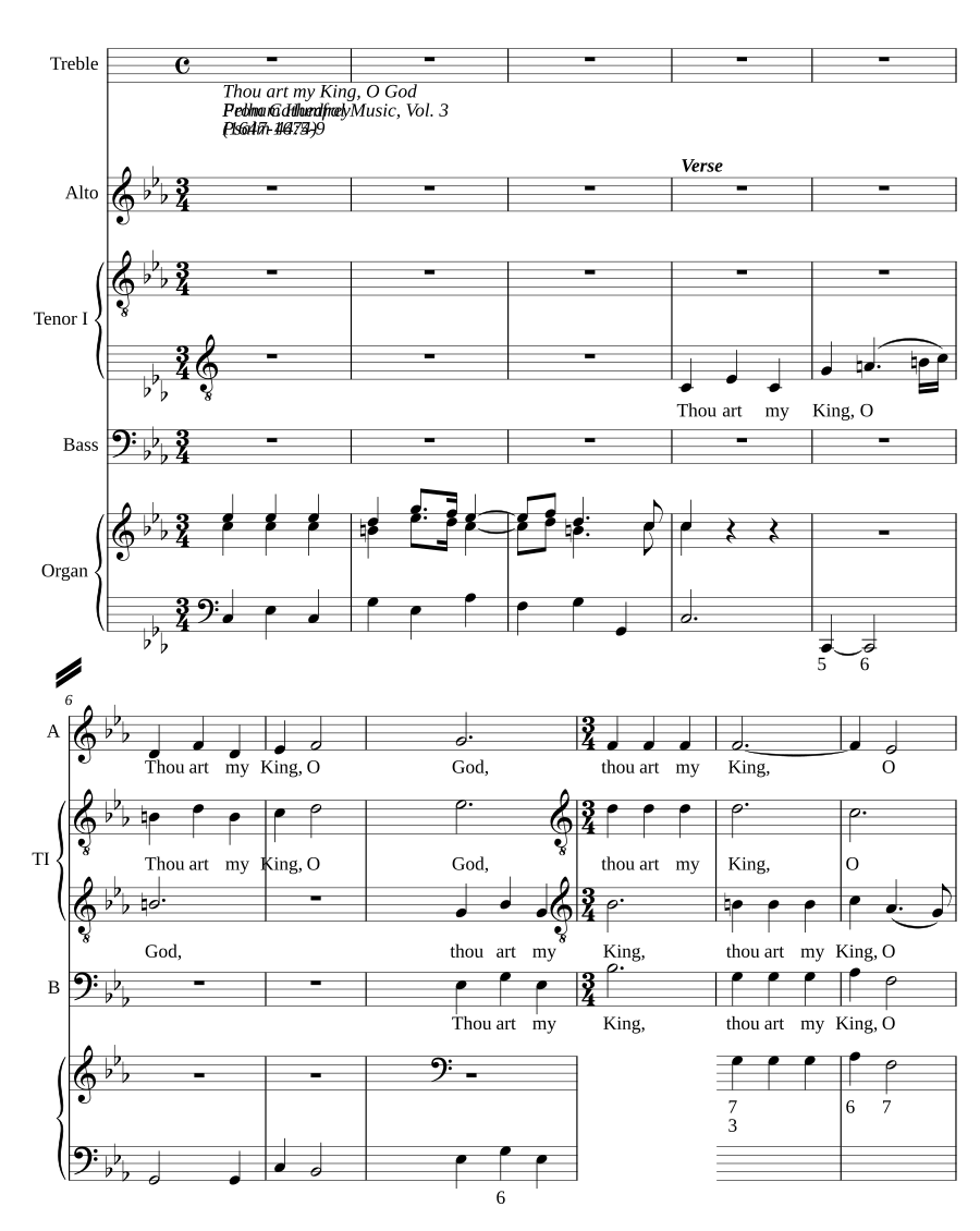 Thou art my King, O God