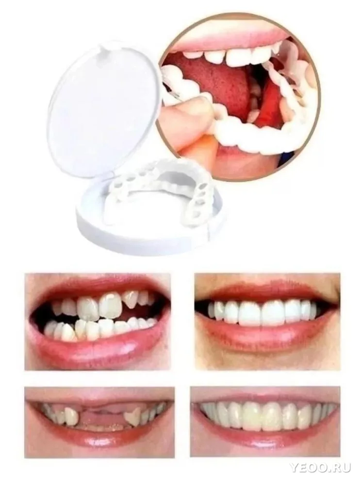 Виниры для зубов SnapOnSmile