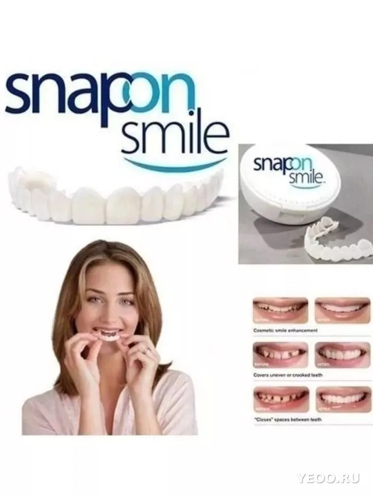 Виниры для зубов SnapOnSmile