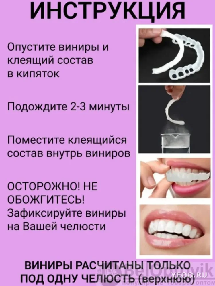 Виниры для зубов SnapOnSmile